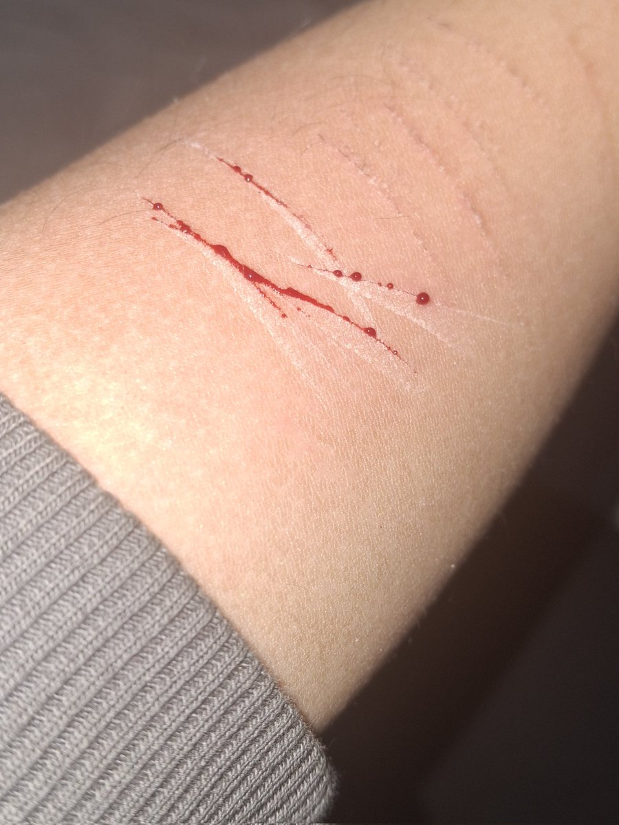 ͜⁞✙⑅ kyle 🦴🍧🐾 ◞ ྀི tweet media