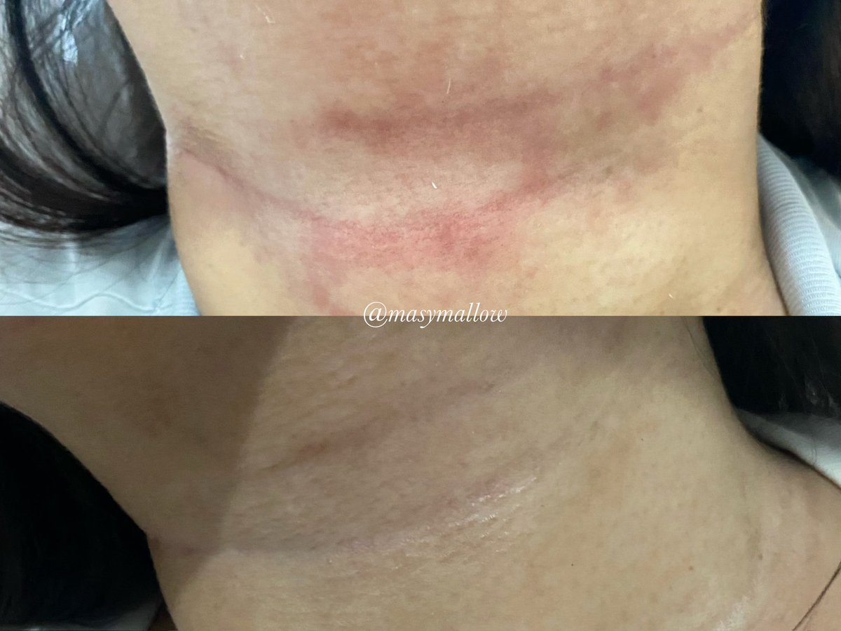 syè 🍒 tweet media