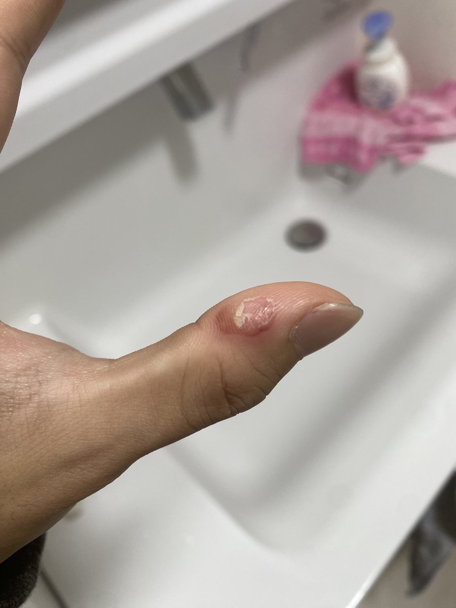 ひーくん tweet media