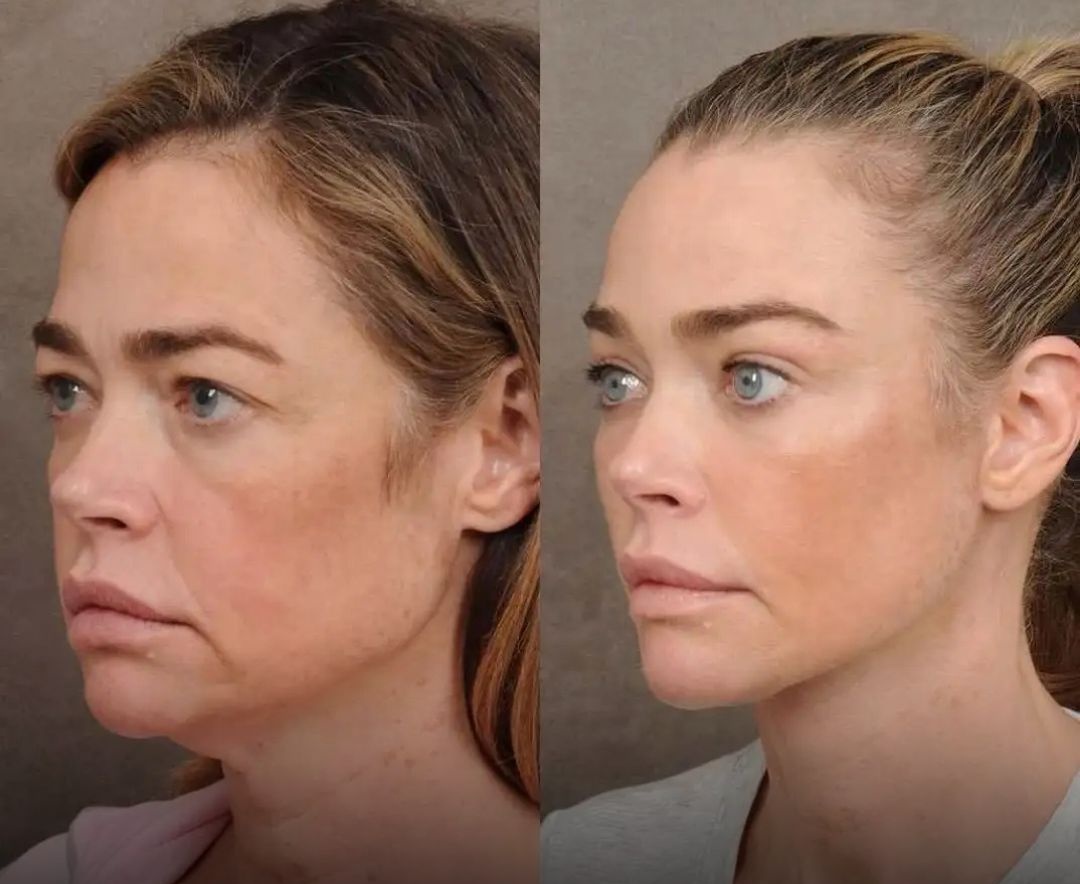 Vince Langman tweet media