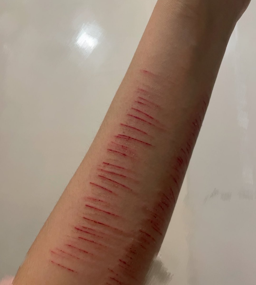 ゆうく;壞掉了♡ tweet media