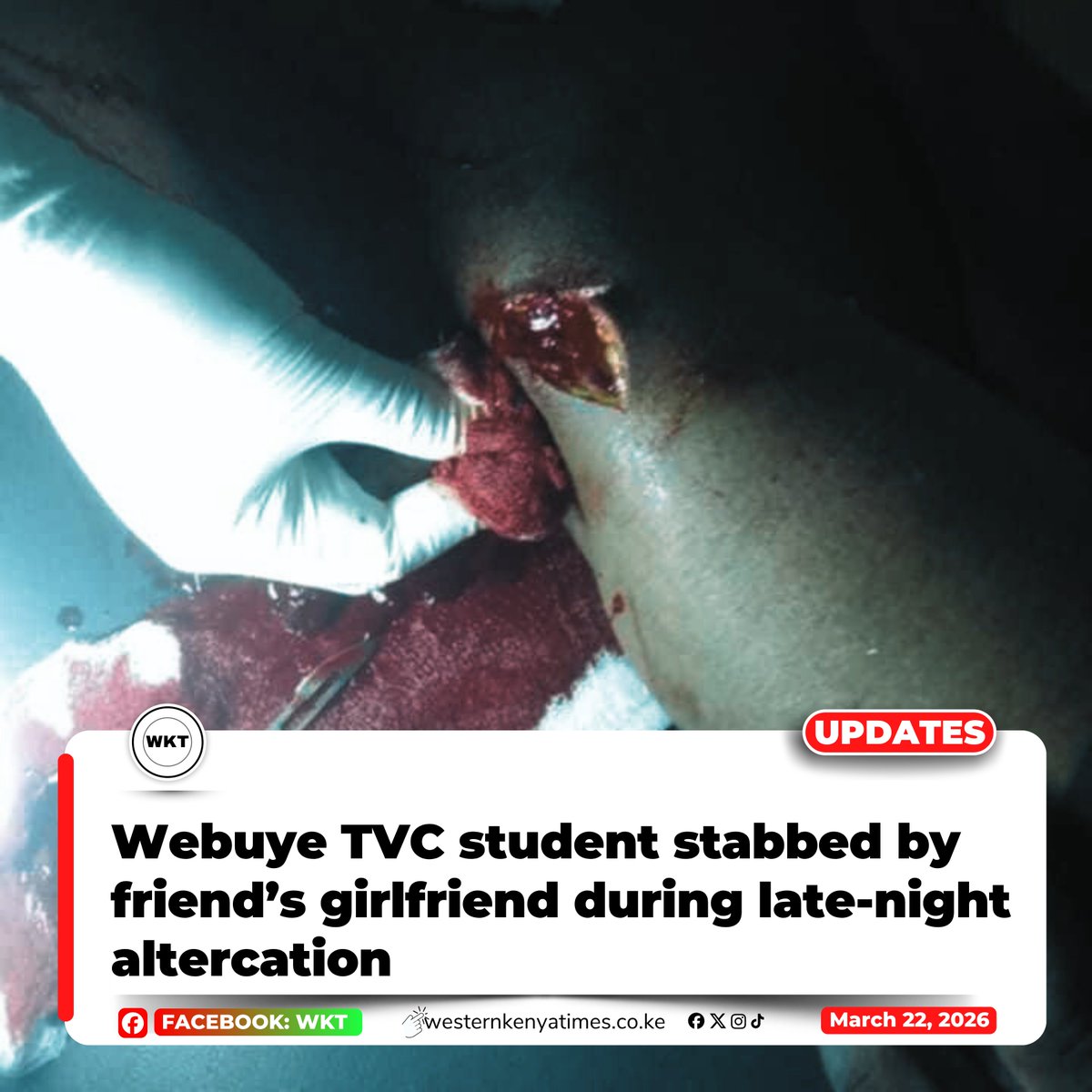 A student of Webuye TVC was reportedly stabbed during a late-night altercation on Saturday involving a group of friends believed to have been drinking together.

Read more: westernkenyatimes.co.ke/2026/03/22/web…