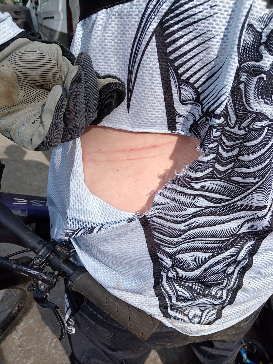 ginge🤟MTB⛰️ tweet media