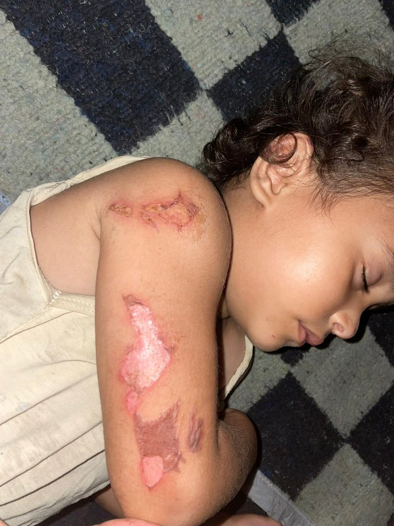 Ahmed in gaza 🇵🇸🍉 tweet media