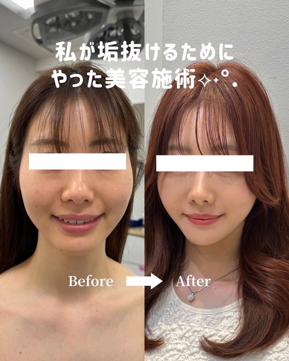 小顔整形 沼澤先生 SEA CLINIC tweet media
