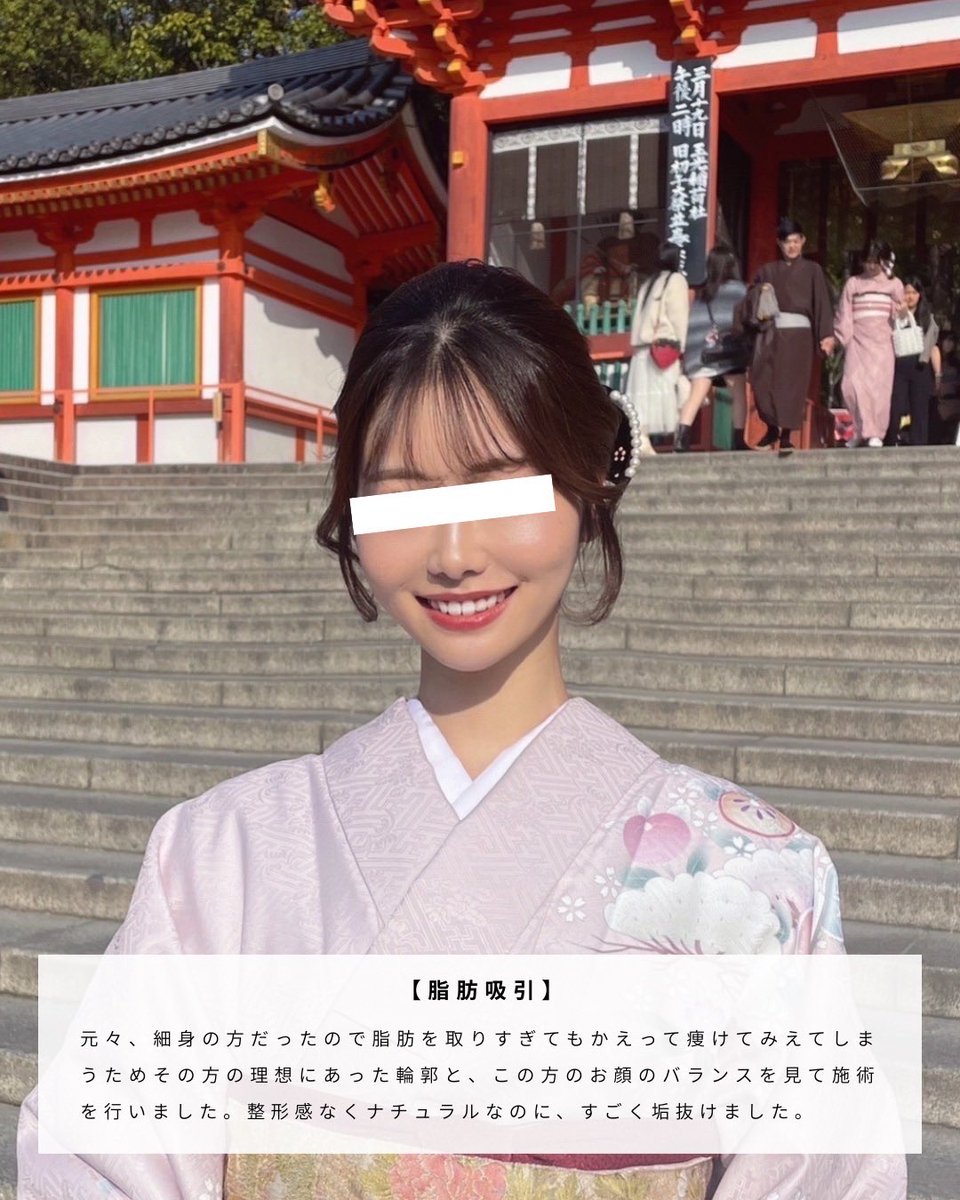 小顔整形 沼澤先生 SEA CLINIC tweet media