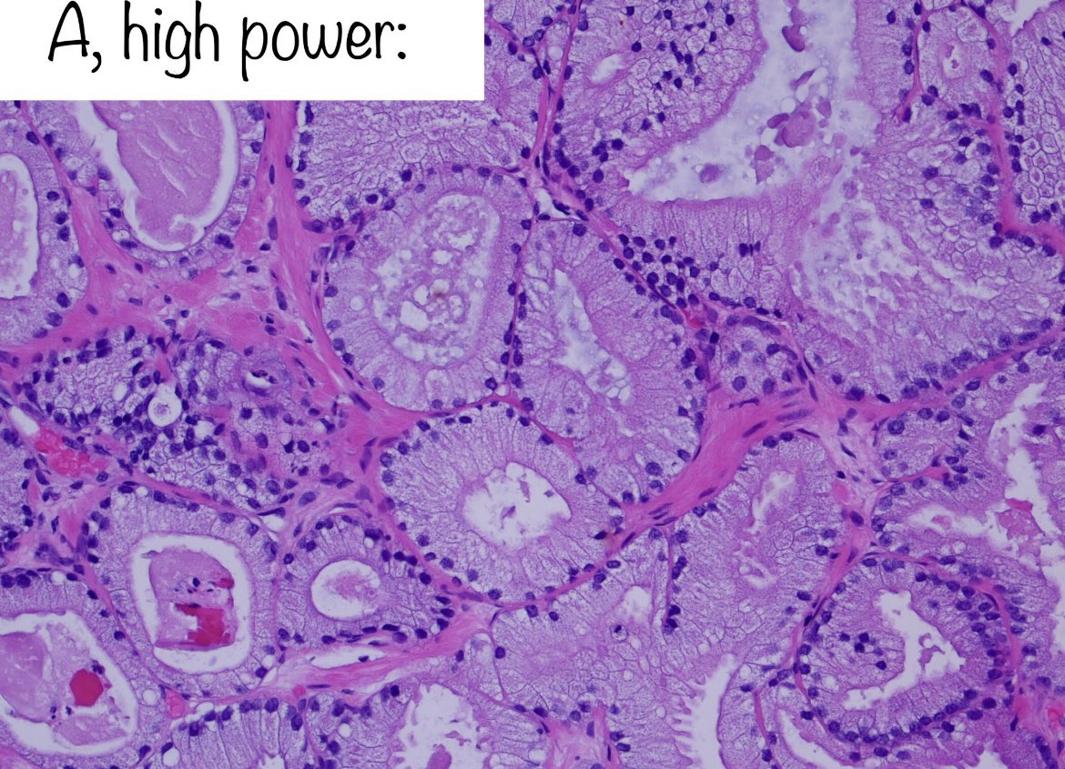 Brown Pathology and Laboratory Medicine tweet media