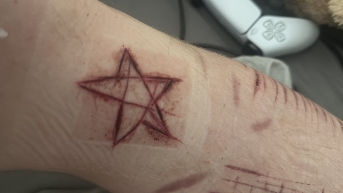 quzooi ❤️‍🩹 tweet media