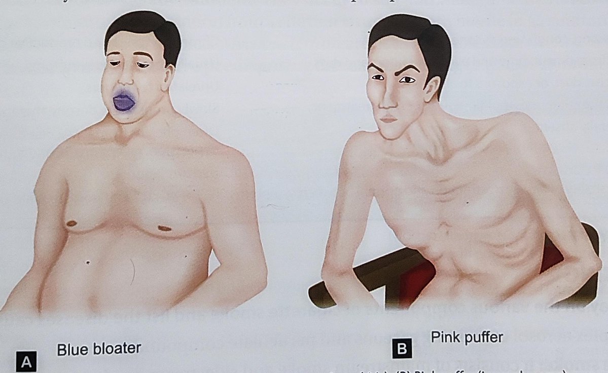 Dr Abdul Hameed 🩺 tweet media