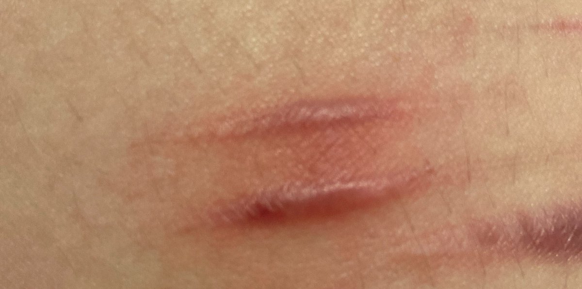 kuzey 𝜗ৎ shtwt tweet media