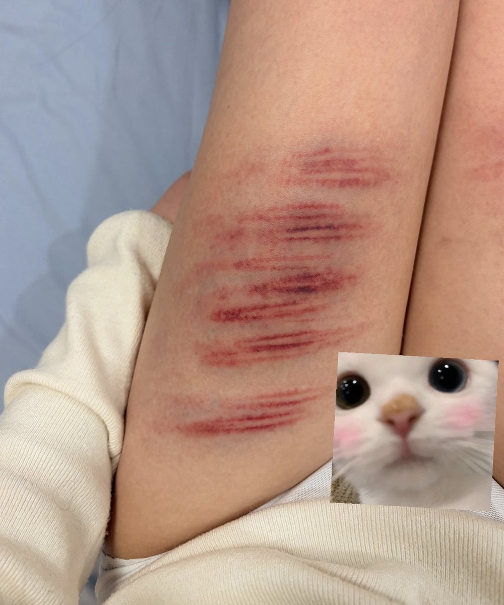 Chelsea_yy tweet media