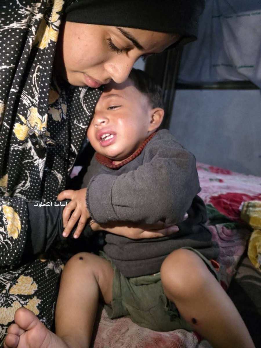 Los pervertidos obligaron a un padre en Gaza a dejar a su bebé en el suelo y entrar a un check point israelí, donde lo desnudaron.

Torturaron al niño frente al padre, quemándole sus piernas con cigarros y pinchándolo con clavos.

El padre sigue secuestrado.

📷 Osama Al-Kahlout