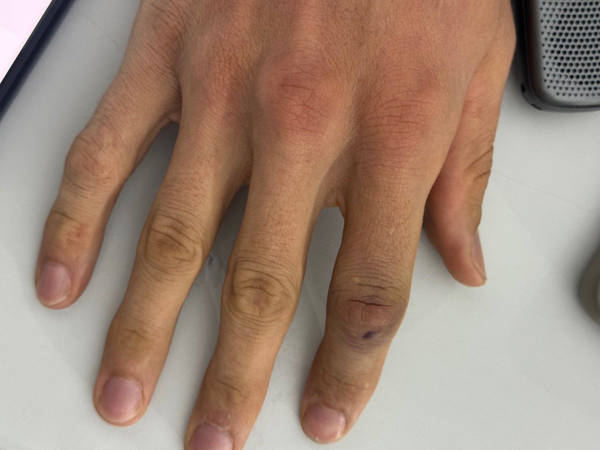 ⁶³ Nene ⁷² || 🦊 tweet media