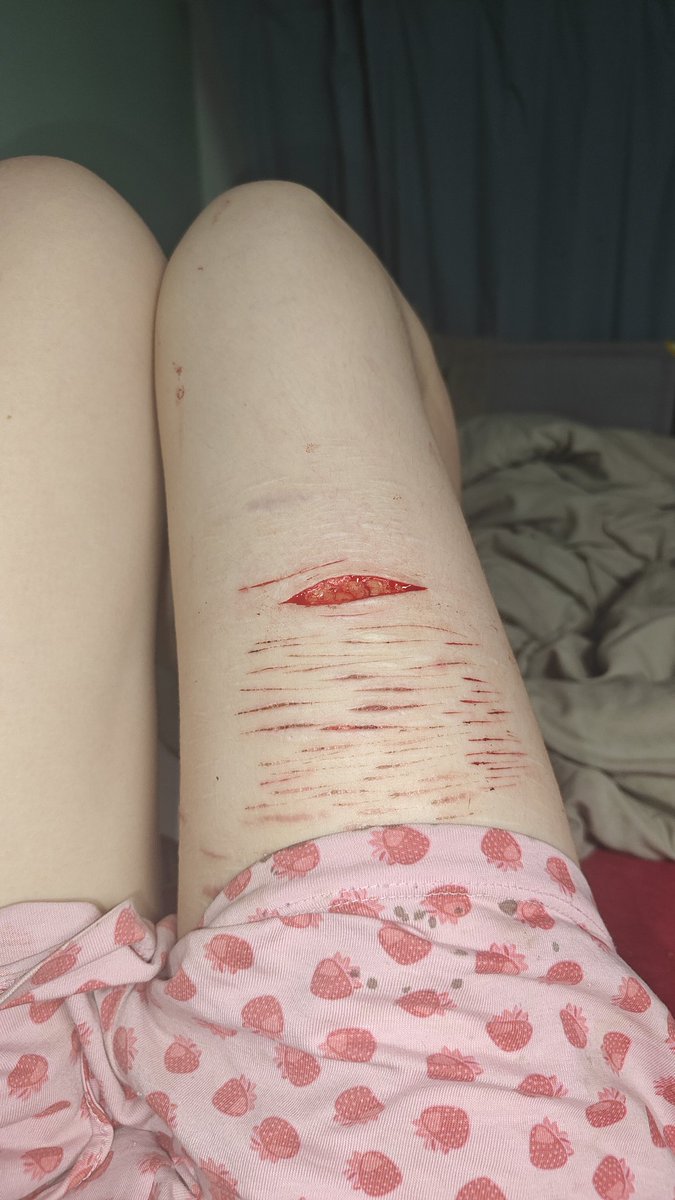 🇵🇱 Thero ★ shtwt 🪽 tweet media