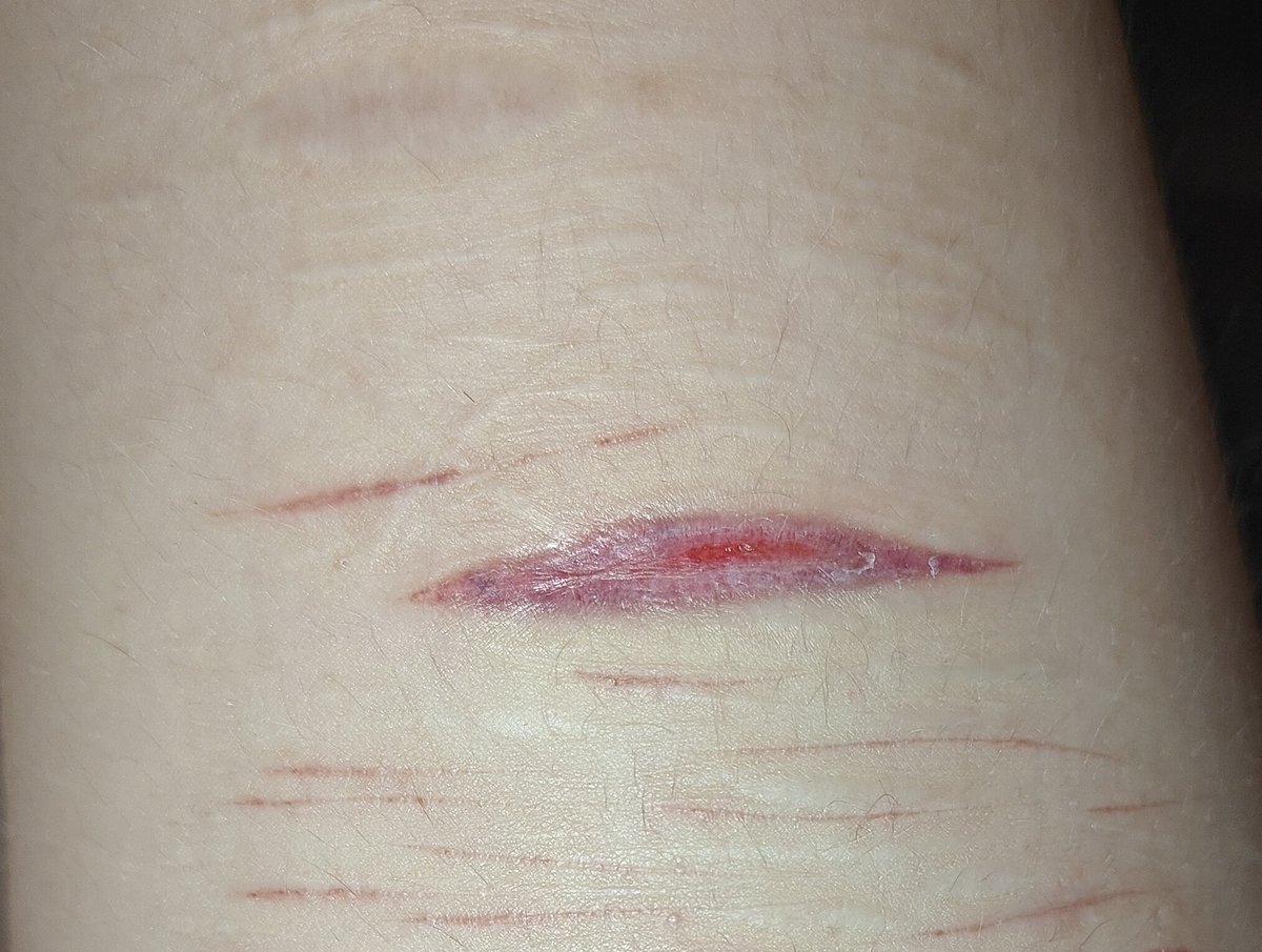 🇵🇱 Thero ★ shtwt 🪽 tweet media