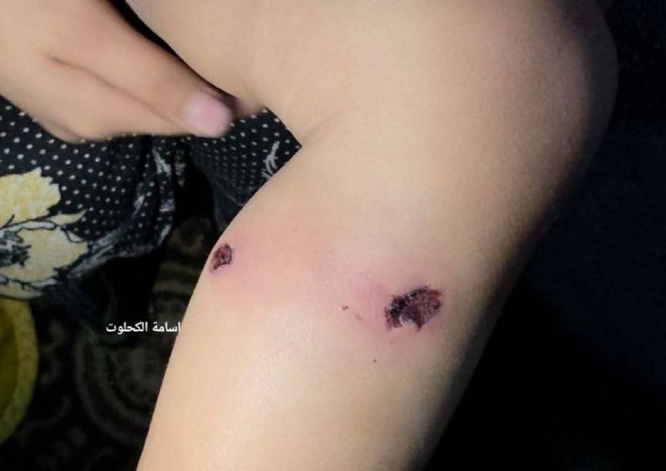 SZade15's tweet photo. Think about this for a second: a 1 year old, defenseless, screaming, in agony, used as a weapon against his own father…while the baby’s father was being interrogated at a checkpoint, the Israeli forces burned the infant with cigarettes, all to force a false confession. https://t.co/iovc4vyPWN
