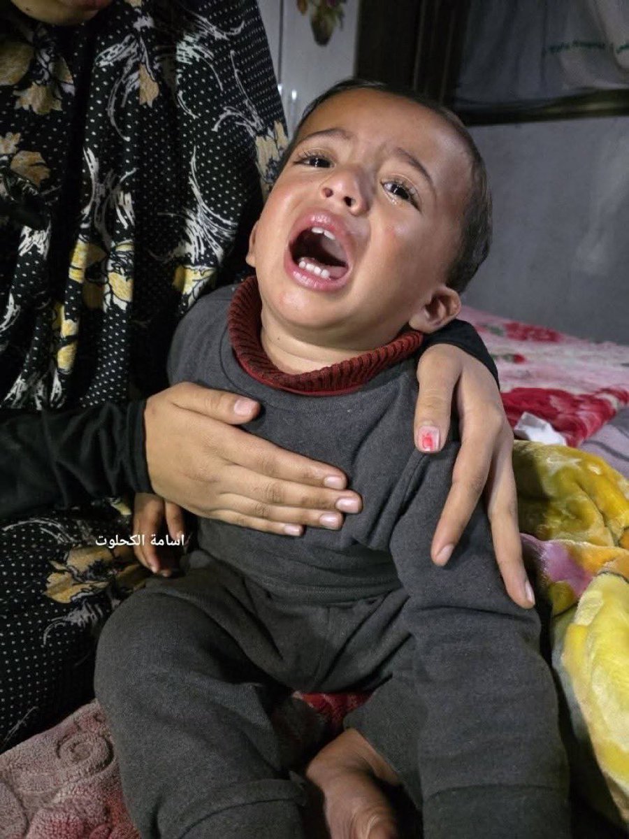 SZade15's tweet photo. Think about this for a second: a 1 year old, defenseless, screaming, in agony, used as a weapon against his own father…while the baby’s father was being interrogated at a checkpoint, the Israeli forces burned the infant with cigarettes, all to force a false confession. https://t.co/iovc4vyPWN