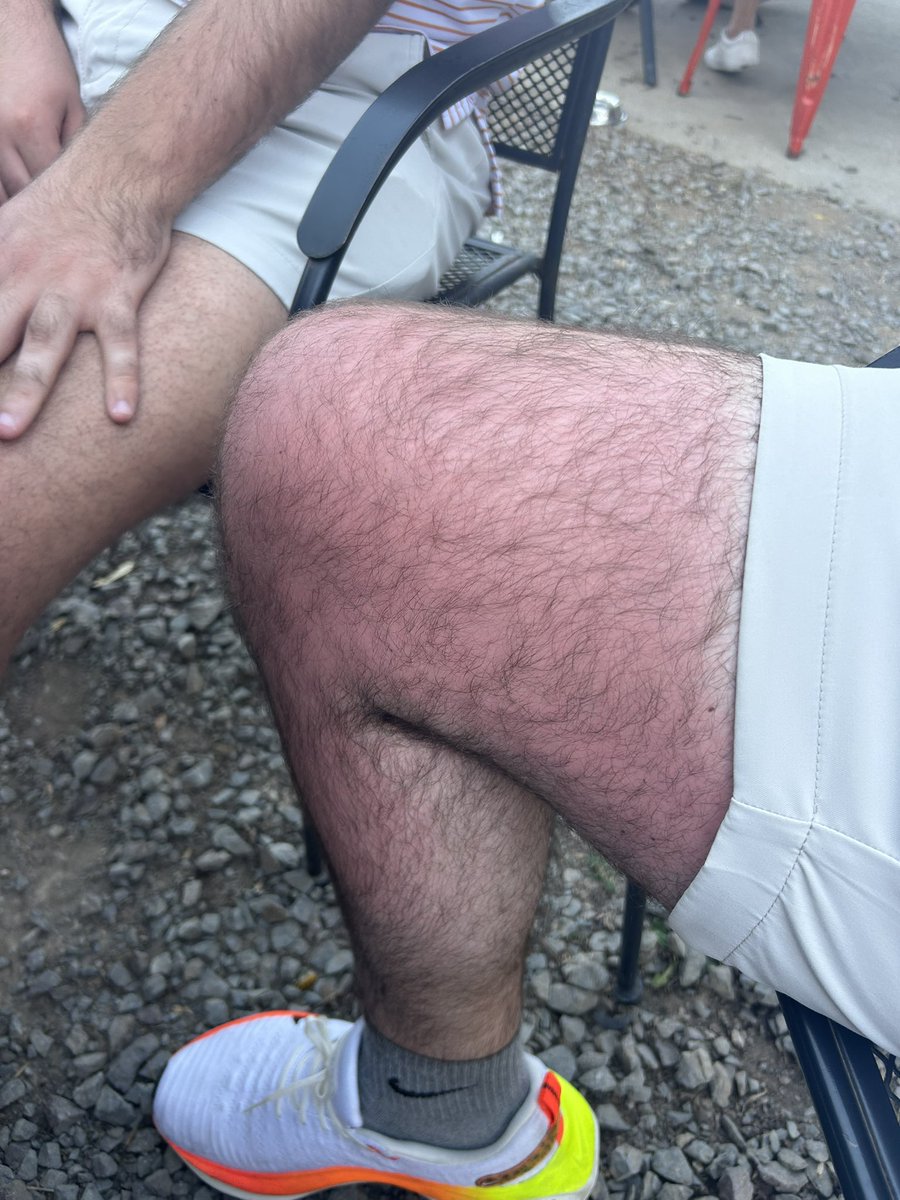 anthebaker tweet media