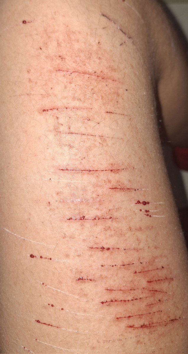 ͜⁞✙⑅ kyle 🦴🍧🐾 ◞ ྀི tweet media