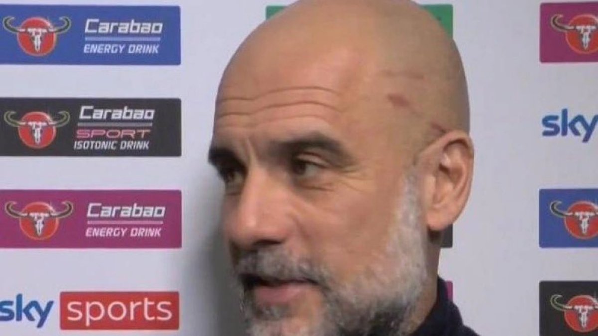 🚨🚨🚨 عااااااااااااااااااااااااااااااااااااااااااااااااااجل!!!!!

جروح غريبه ظهرت على وجه غوارديولا قبل انطلاق النهائي 😱😱😱😱😱😱❌❌❌❌❌❌

[besoccer_ES - <a href="/TrendEPL/">الدوري الإنجليزي™</a> ]