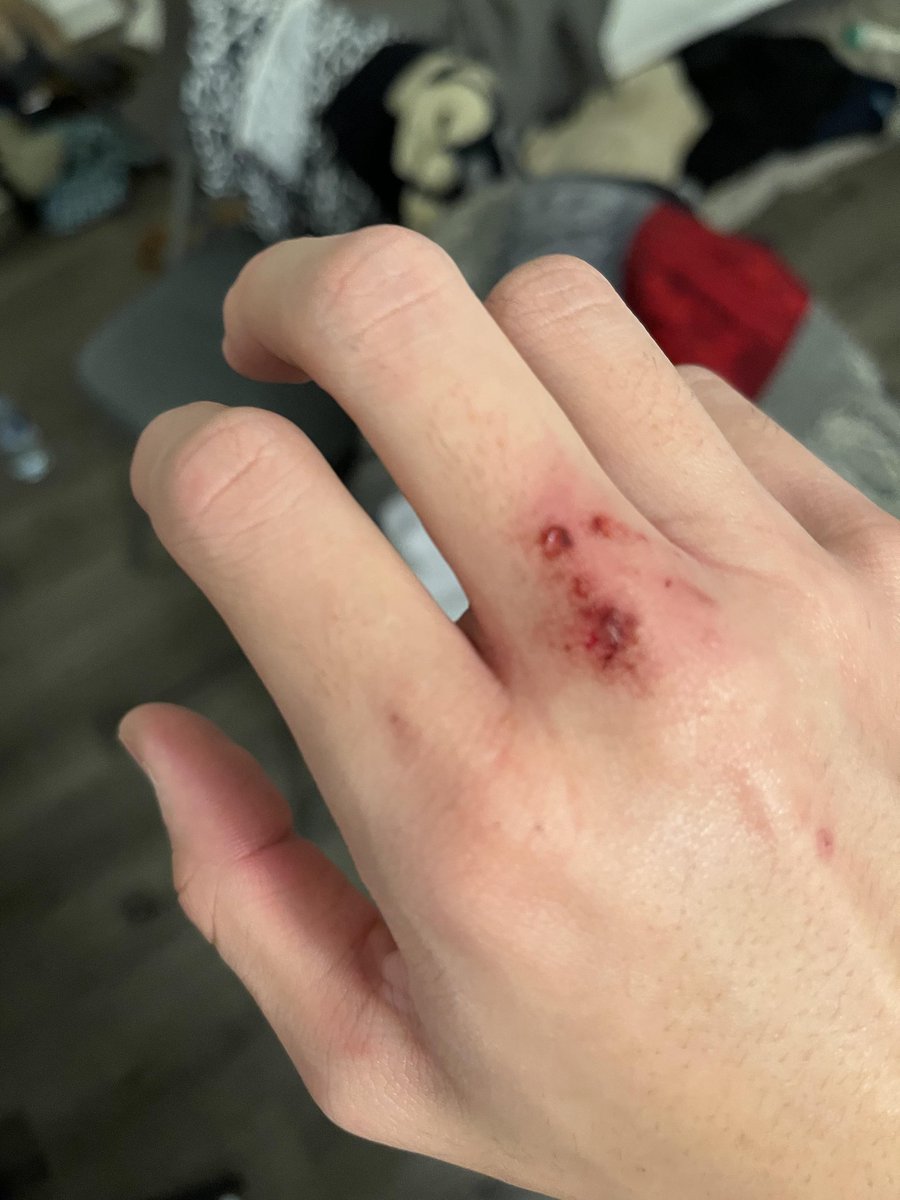 Dr Abdul Hameed 🩺 tweet media