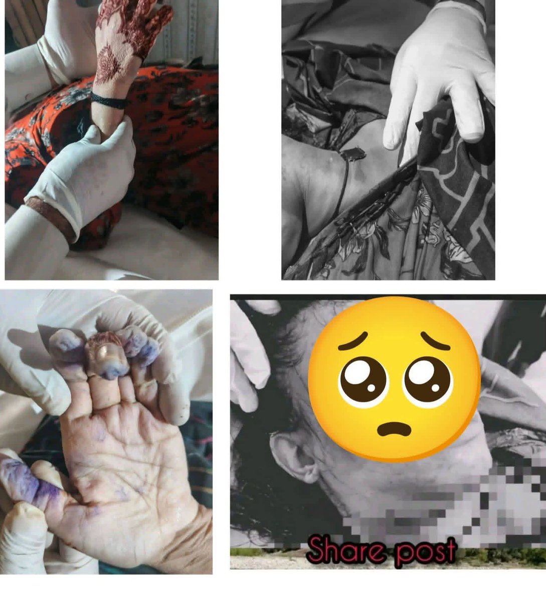 تتہ پانی پل کے نیچے دریائے پونچھ سے ایک نامعلوم لڑکی کی ڈیڈ باڈی ریسکیو کر کے کوٹلی منتقل کر دی گئی ہے مگر افسوس کہ ابھی تک اس بہن کے ورثاء کا کوئی سراغ نہیں مل سکا 🥺 ڈیڈ باڈی بالکل فریش حالت میں ہے اور جسم پر موجود نشانات کئی سوالات کو جنم دے رہے ہیں، انگلیاں ٹوٹی ہوئی ہیں،