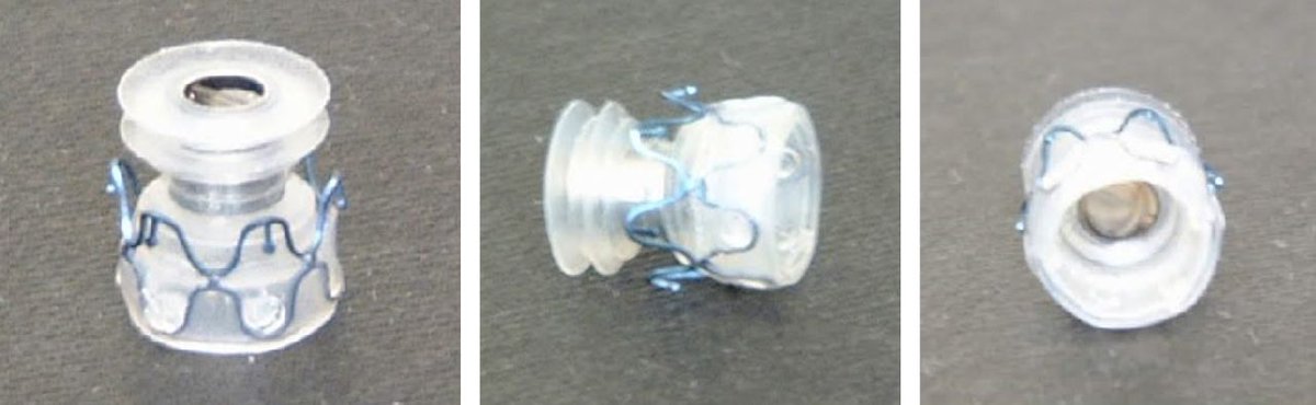 Breathe: Endobronchial valves are a less invasive endoscopic method in patients with heterogeneous emphysema, for whom surgery may be risky bit.ly/3YkPDu7