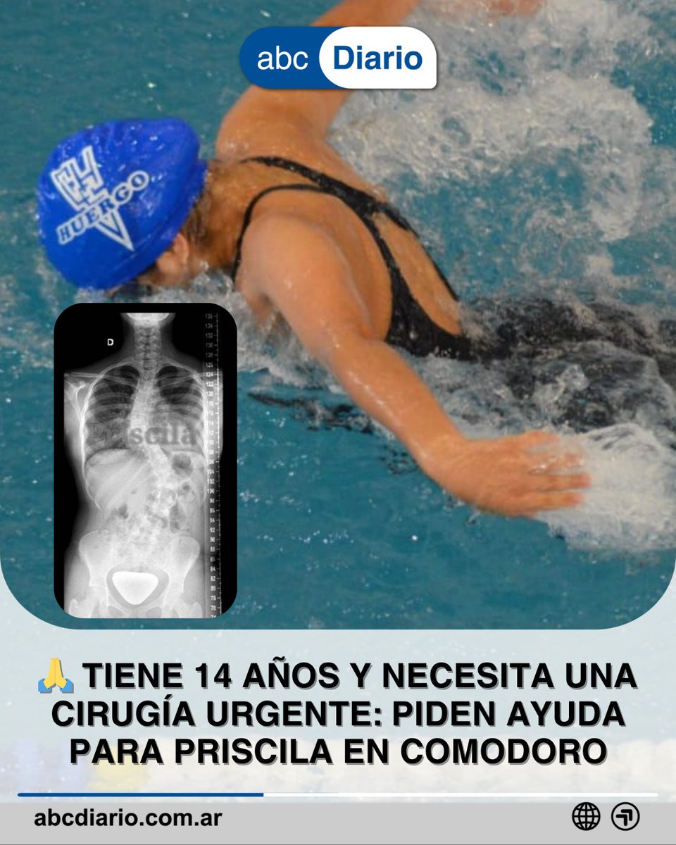 abcdiarioar tweet media