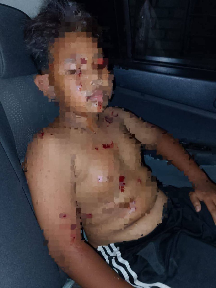 update11111's tweet photo. TRAGEDI PAKAR BOM DARI TOBIAR, PENDANG. KEDAH 
Ujikaji custom mercun bola..
7 mangsa beraya di Hospital.. https://t.co/bwavB6UYFX