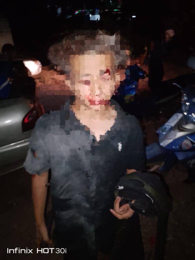 update11111's tweet photo. TRAGEDI PAKAR BOM DARI TOBIAR, PENDANG. KEDAH 
Ujikaji custom mercun bola..
7 mangsa beraya di Hospital.. https://t.co/bwavB6UYFX