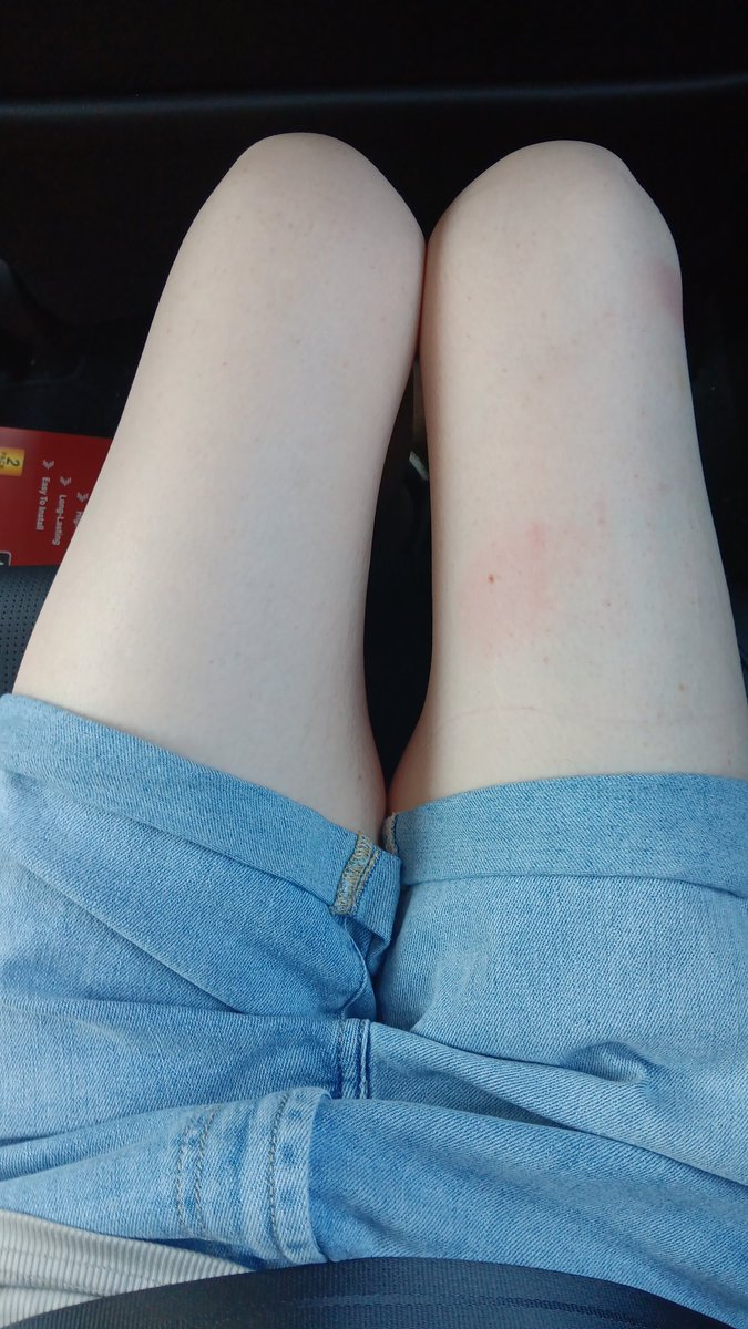 sundaem1lkshake's tweet image. #skinnyfat