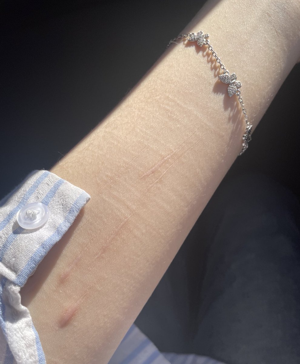 scars in the sun
