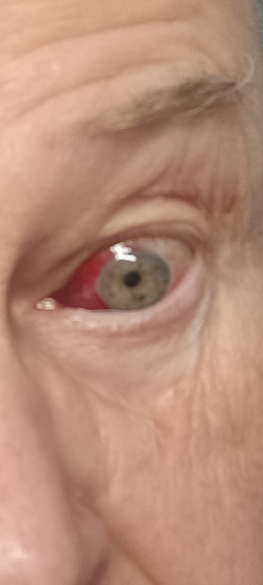 Kai Nilakari tweet media