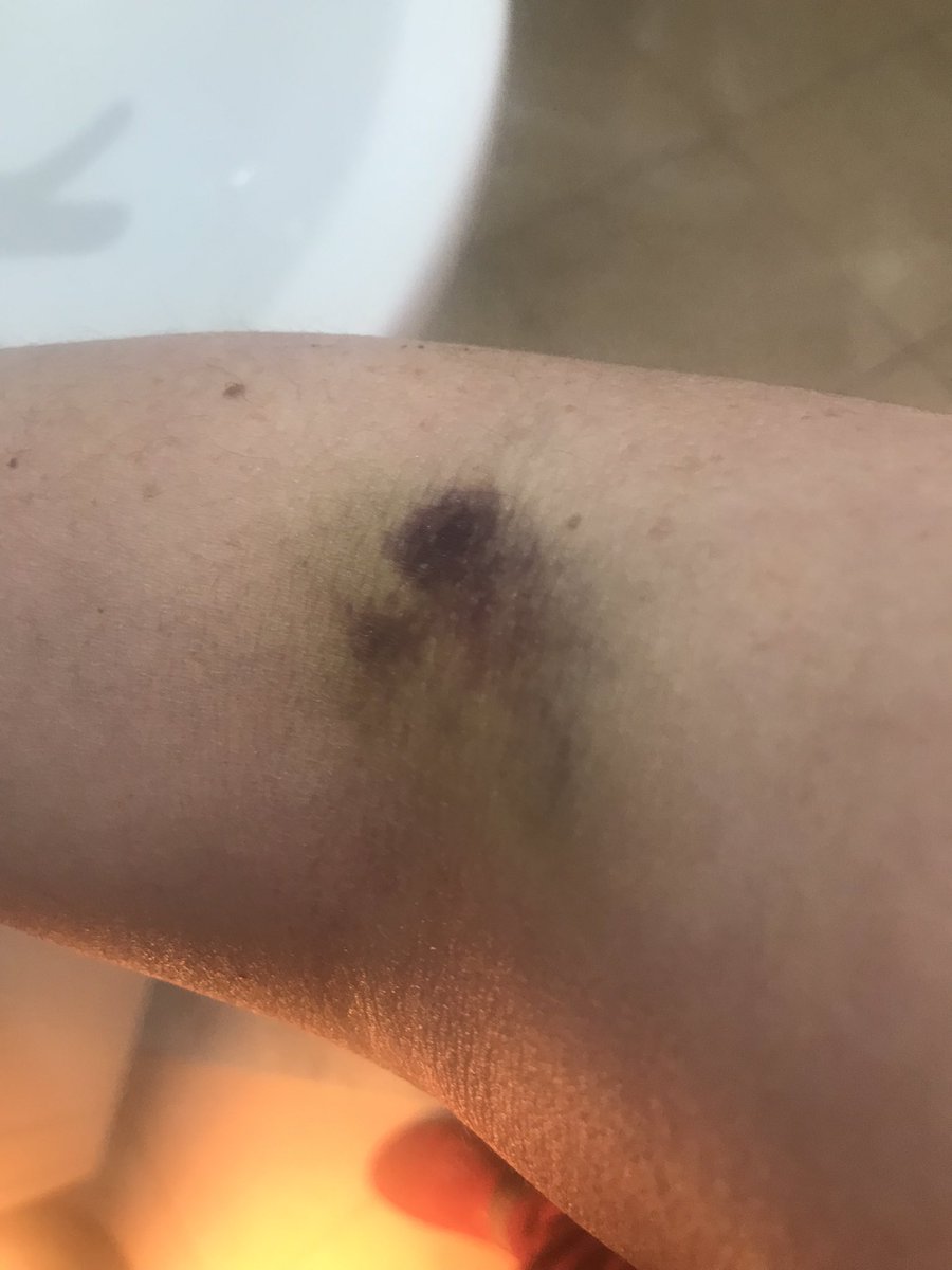 Isabella 🕊 tweet media