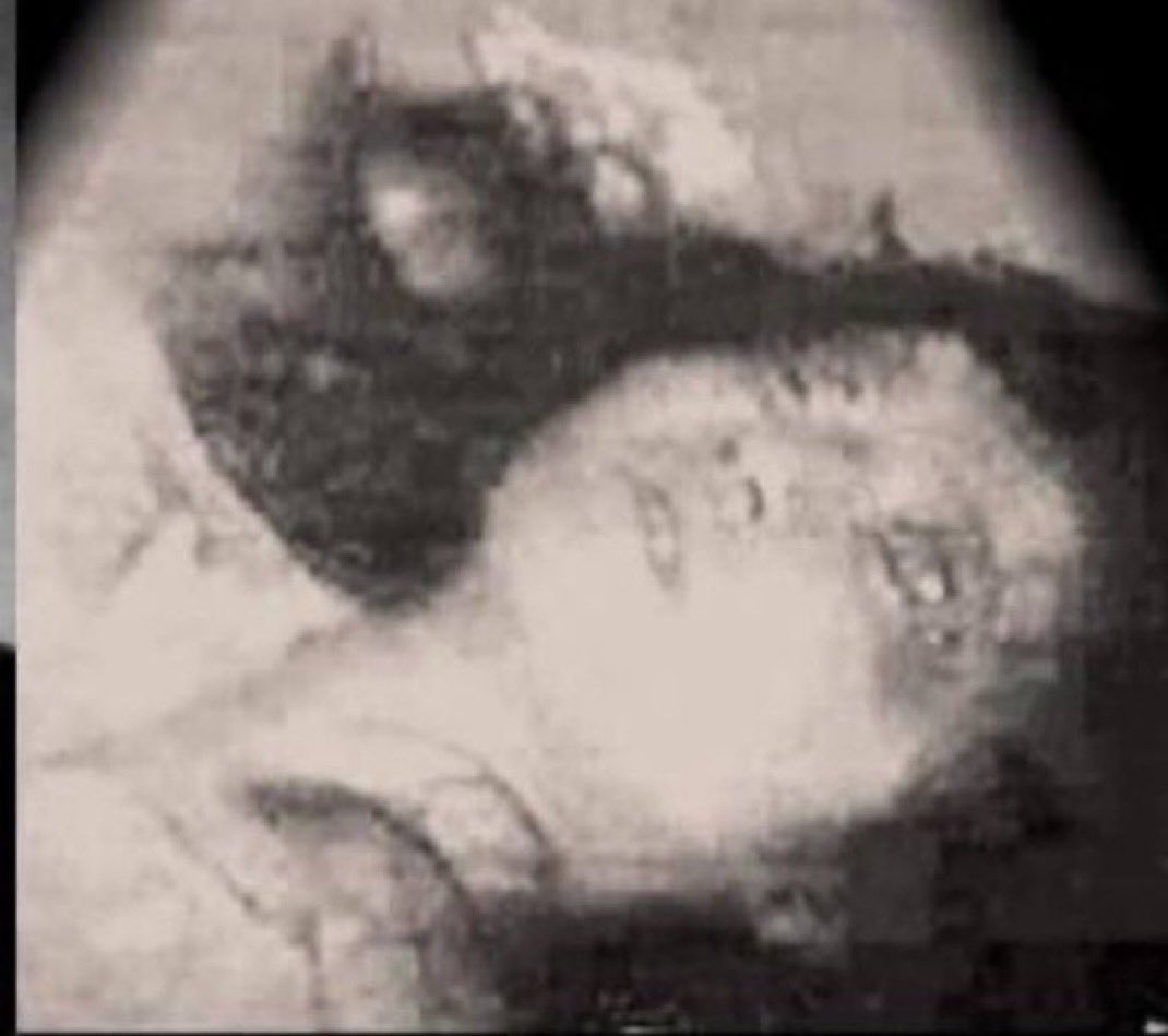 ᴴͥᴵᴸͣᴸͫᴮᴵᴸᴸʸ ᶜᴬᴿᴸ 🇺🇸🇮🇱 tweet media