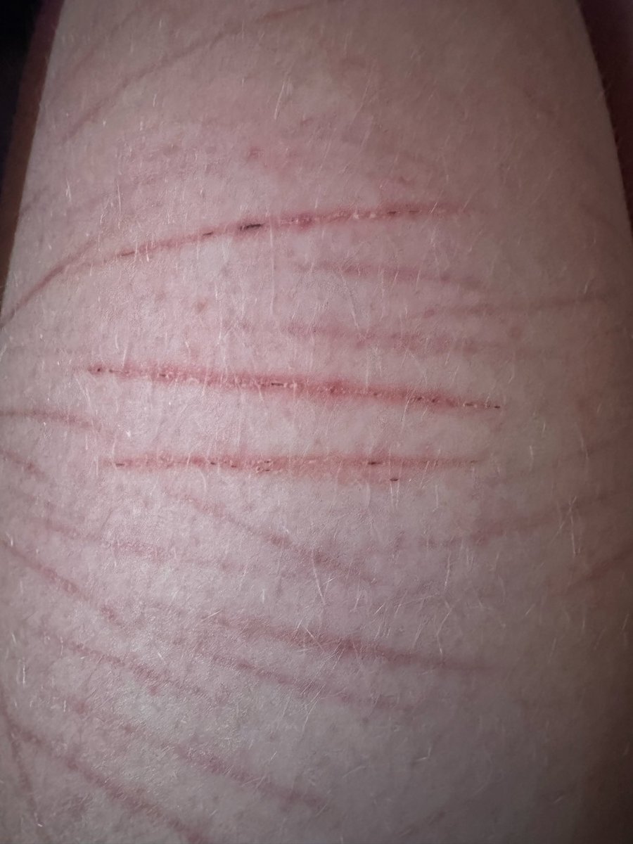 LALA lover - SHEDTWT 𐔌՞ ܸ.ˬ.ܸ՞𐦯 tweet media