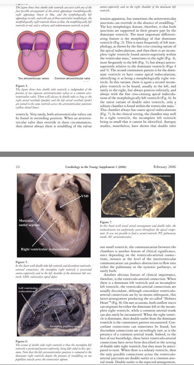 cardiopedhnn's tweet photo. Very nice reviews of #DILV
https://t.co/mMIcLG4cQh
https://t.co/tVsQWSDH8e
https://t.co/E4lEHYusMu
#CHD #pedsheart #cardioped https://t.co/bmckPcrVGA