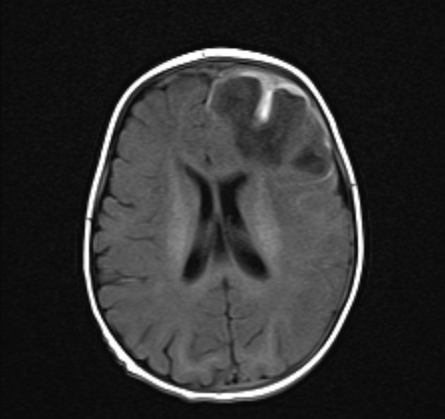 Evan Calabrese, MD PhD tweet media