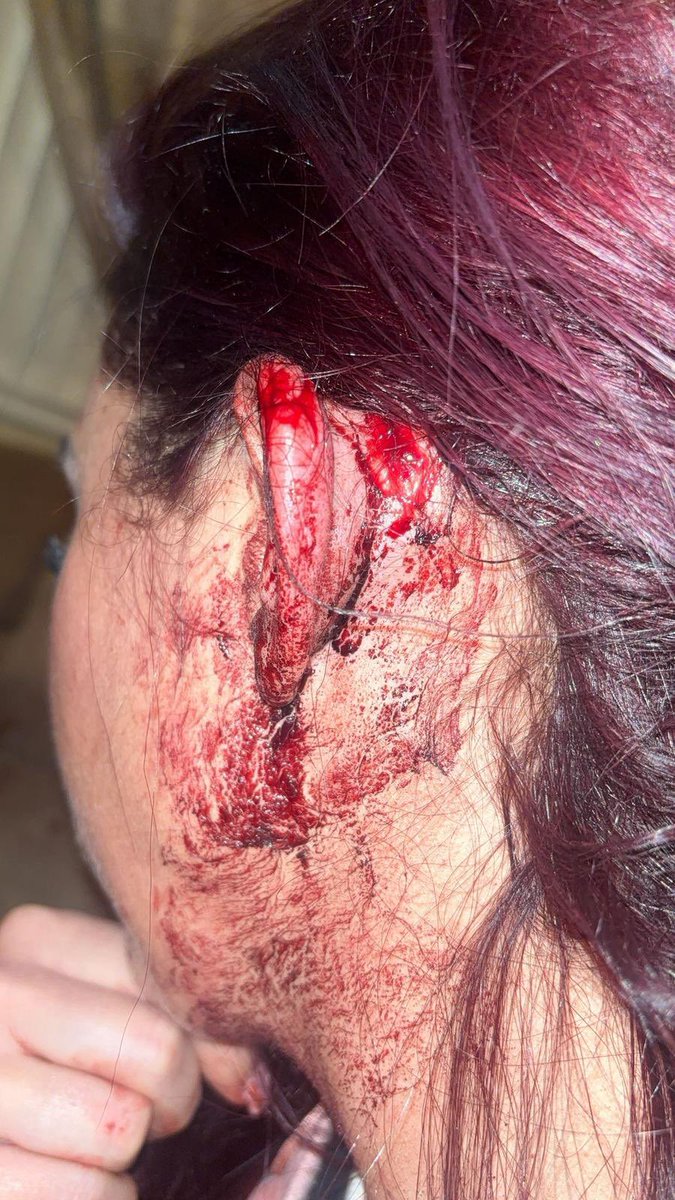 Shorty 4.0 tweet media