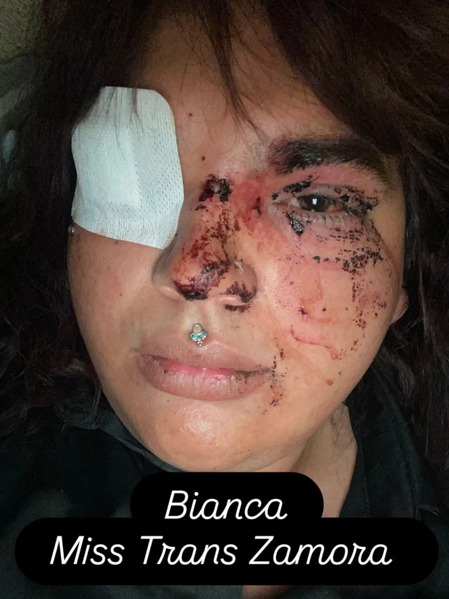 🔻Mar Cambrollé 🏳️⚧️ Hay Ley Trans tweet media