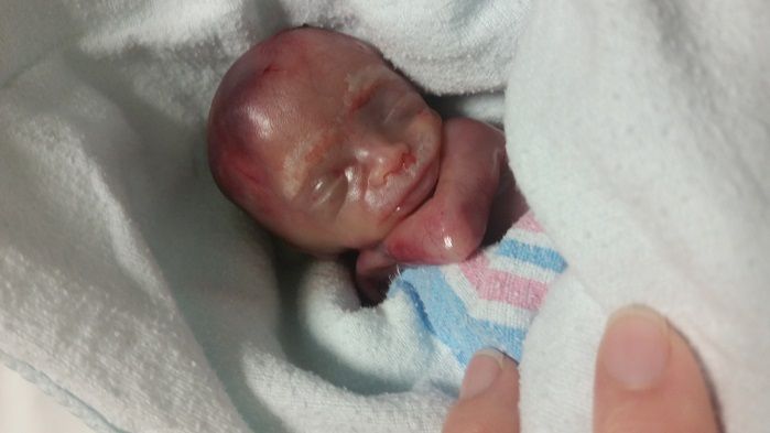 LifeNews.com tweet media