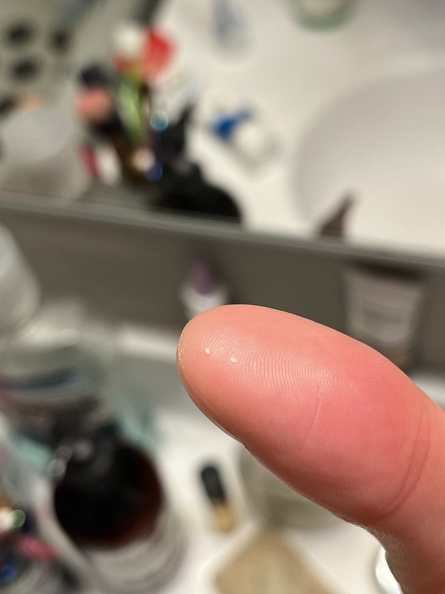 Bite onto a fork by accident