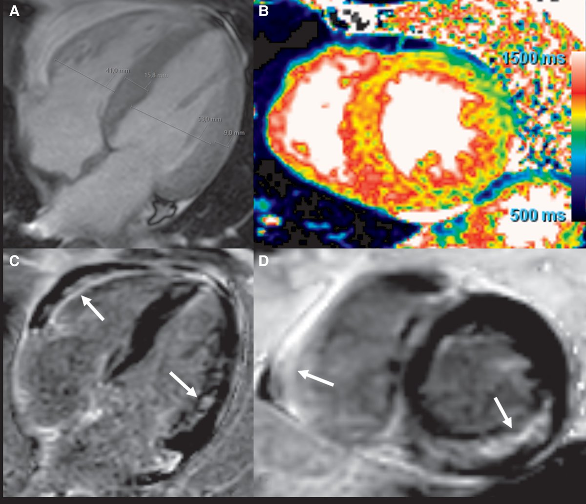 European Society of Cardiology Journals tweet media