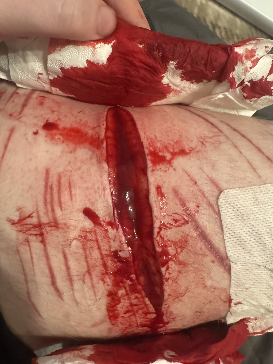 quzooi is limited by x 💔 tweet media