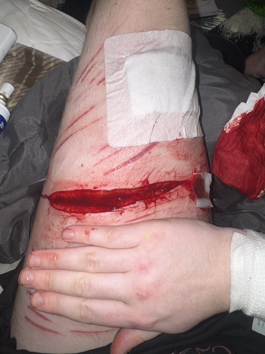 quzooi is limited by x 💔 tweet media