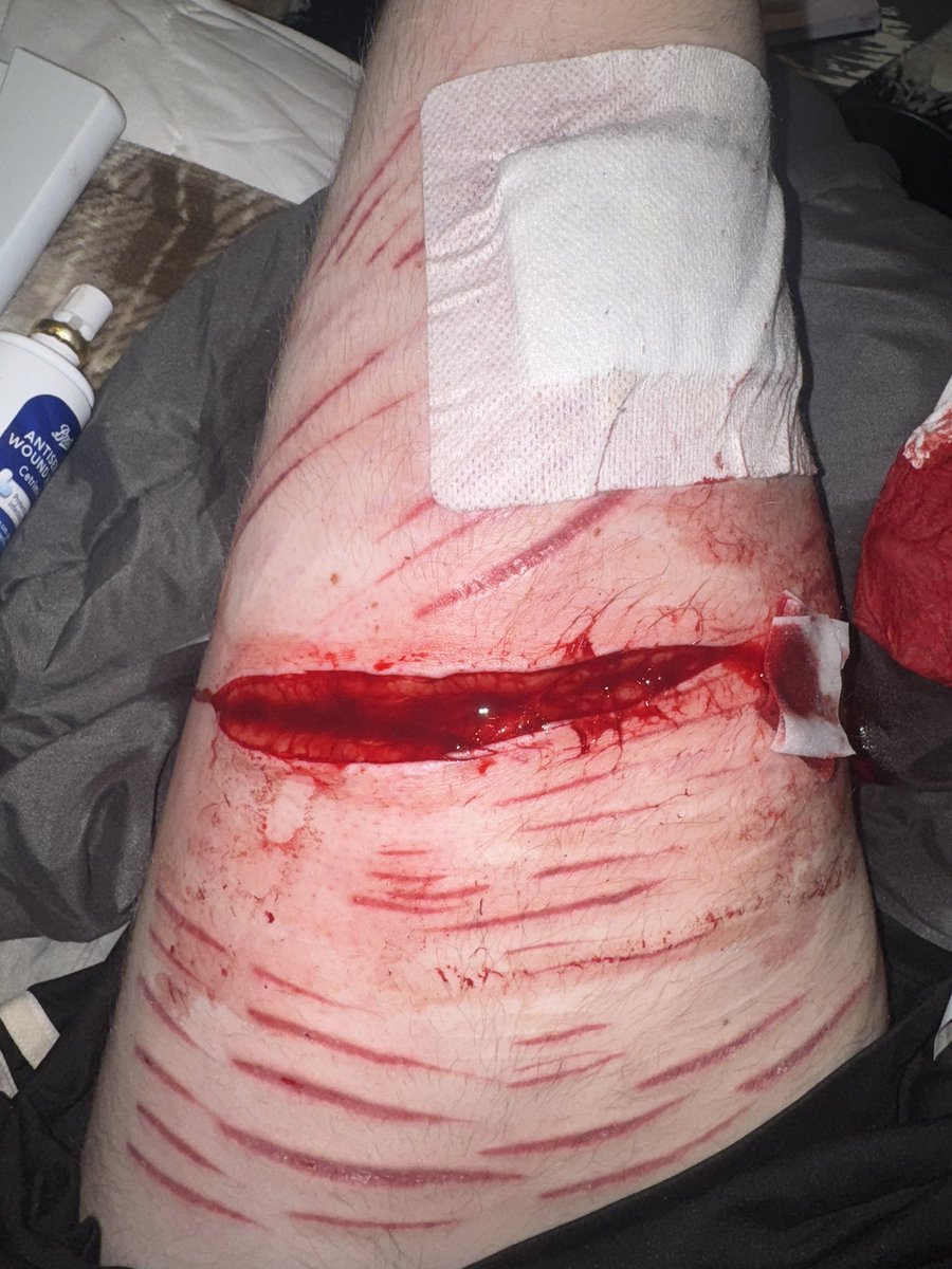 quzooi is limited by x 💔 tweet media