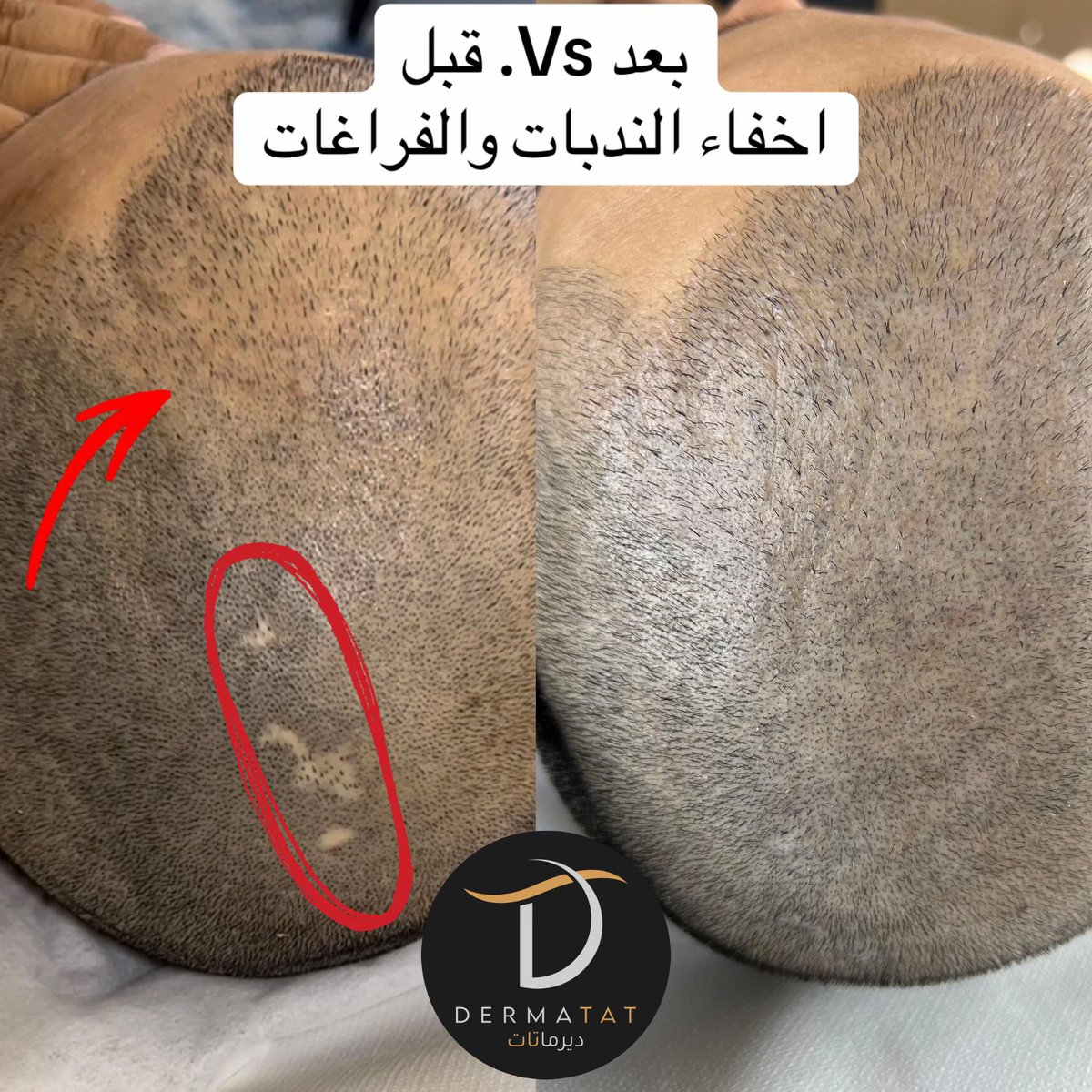 نواف العصيمي tweet media
