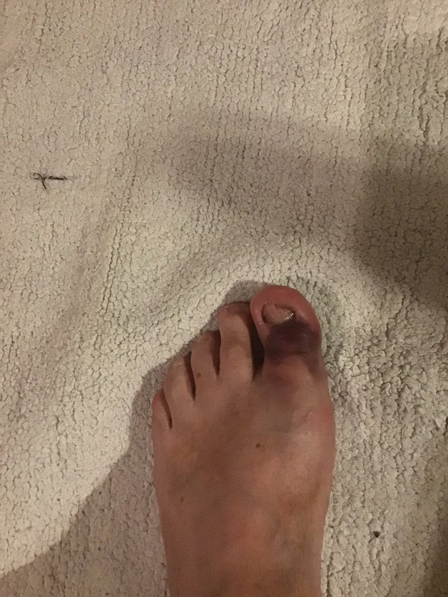 Alan Wright 🦫 tweet media