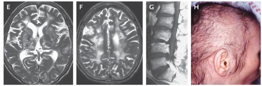 WalidoNeuroPedia tweet media