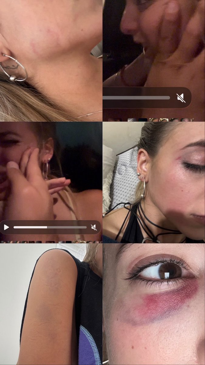 QUIERO QUE ESTE ENFERMO NO PISE MÁS LA CALLE, ARIEL CORIA ALIAS “BETO CORIA” GOLPEÓ EN REITERADAS OCASIONES A MI AMIGA, QUEREMOS JUSTICIA Y QUE NO LE PASE MÁS A NINGUNA!!! 
DIFUNFIR!!!!!